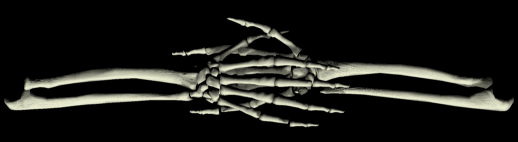 hand bones divider